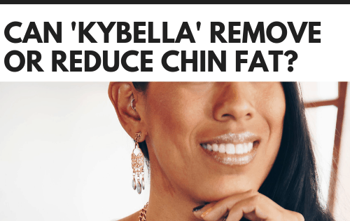 Can Kybella remove or reduce chin fat?