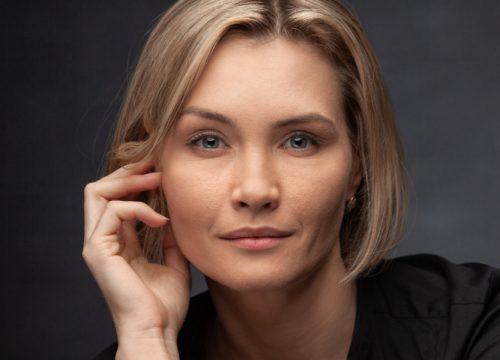 Woman with droopy eyelids