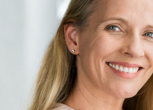 Happy middle-age woman who received facial resurfacing