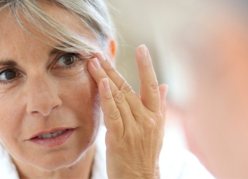 Woman with wrinkles and fine lines