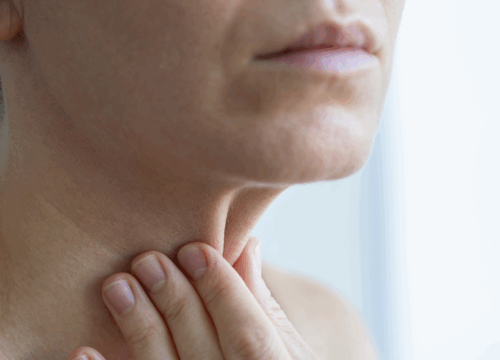 Skin Laxity