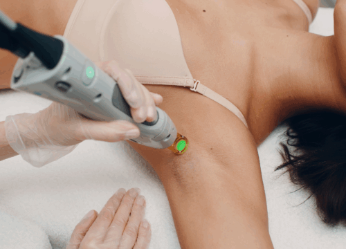 Unwanted Hair