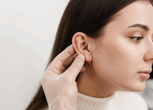 Earlobe Repair
