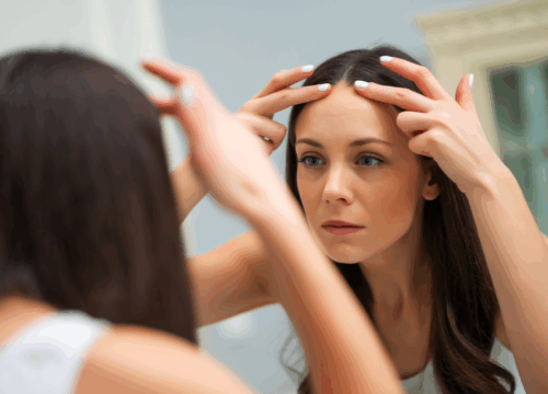 Eyebrow / Forehead Sagging