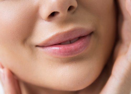 Close-up on a woman's lips after Restylane treatments