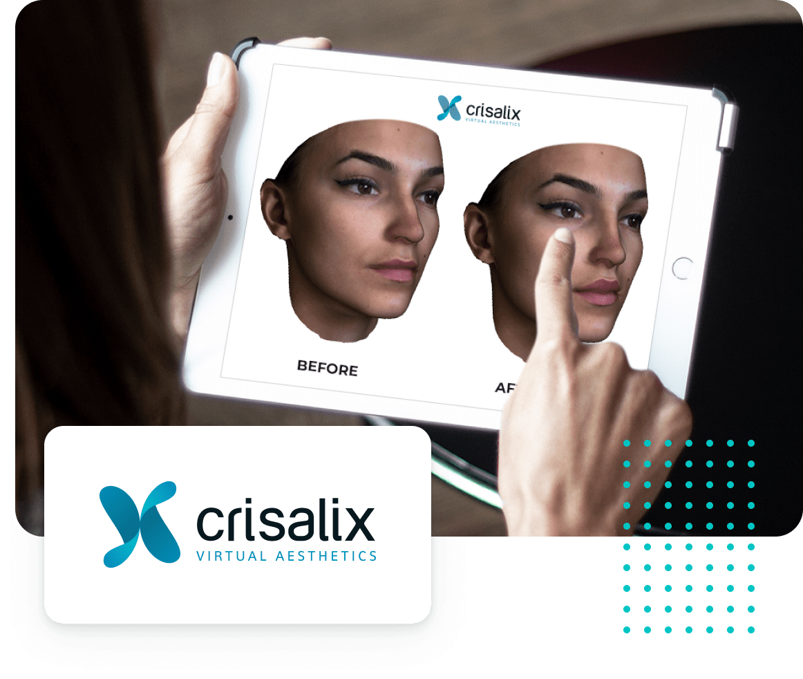 Discover Your Future Self with Crisalix 3D Simulation: Visualize the Beautiful Possibilities of Plastic Surgery