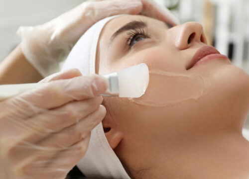 Medical Chemical Peels – Everything You Need to Know About Deep Peels
