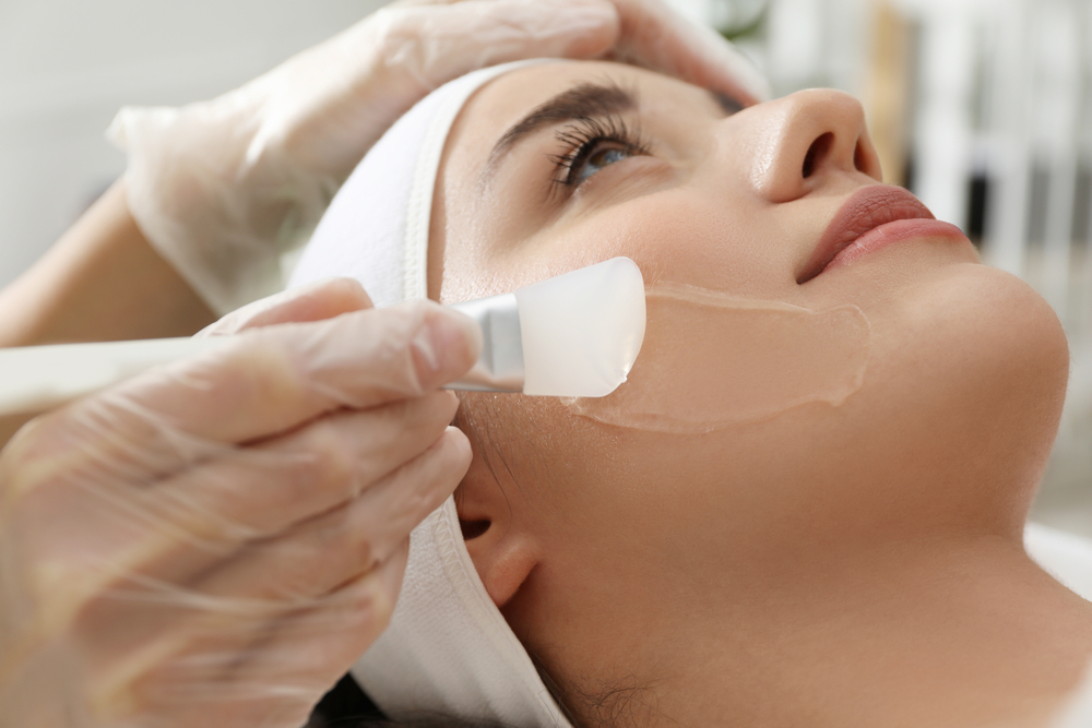 Medical Chemical Peels – Everything You Need to Know About Deep Peels