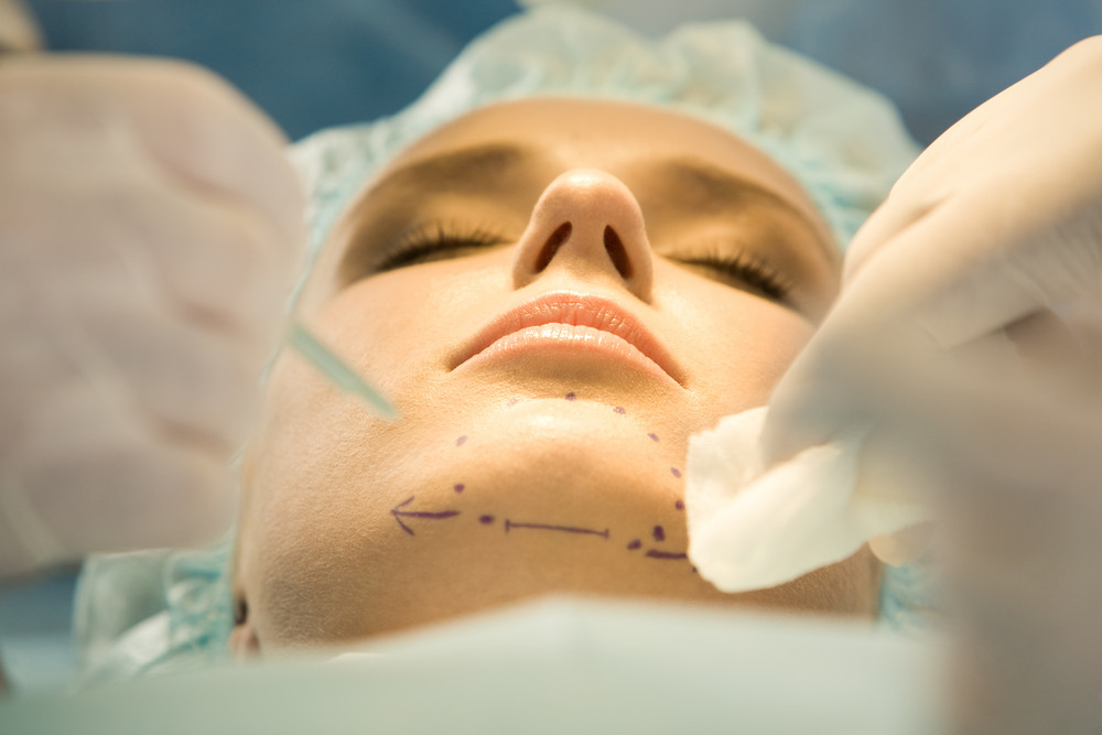 3 Ways a Chin Implant Can Boost Your Confidence